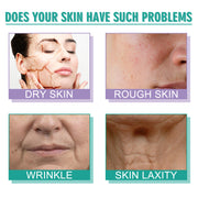 Moisturizing Skin Care Cream