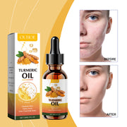 Turmeric Oil